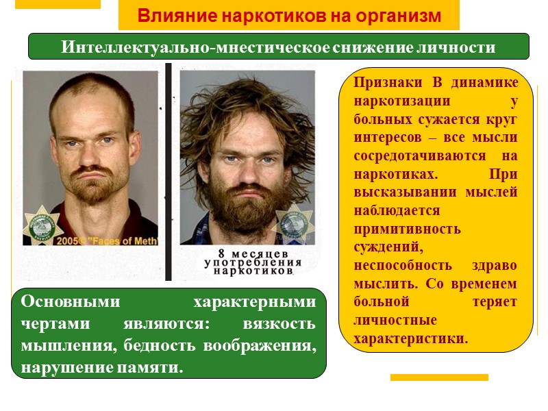 Влияние наркотиков на организм Интеллектуально-мнестическое снижение личности Основными характерными чертами являются: вязкость мышления, бедность